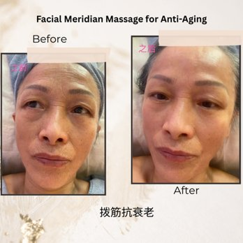 Meridian massage 拨筋